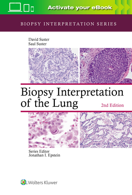 【预订】Biopsy Interpretation of the Lung
