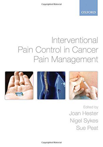 【预订】Interventional Pain Control in Cancer Pain Management