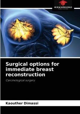 [预订]Surgical options for immediate breast reconstruction 9786204069869