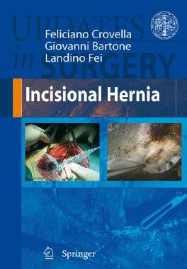 【预订】Incisional Hernia