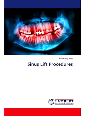 预订 Sinus Lift Procedures: 9786207654437