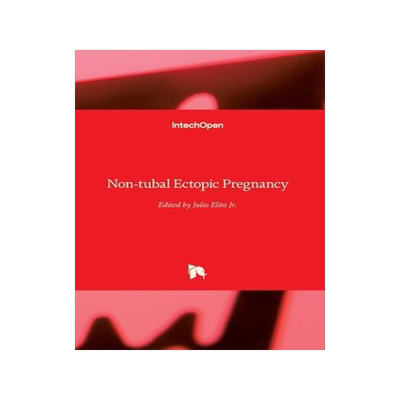 [预订]Non-tubal Ectopic Pregnancy 9781838804541