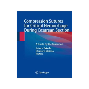 预订 Compression Sutures for Critical Hemorrhage During Cesarean Section