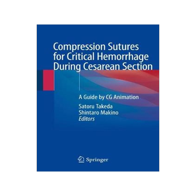 预订 Compression Sutures for Critical Hemorrhage During Cesarean Section
