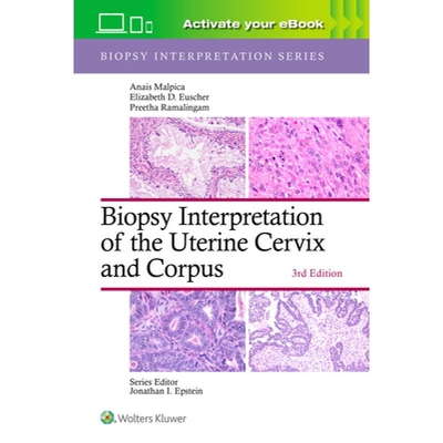 预订 Biopsy Interpretation of the Uterine Cervix and Corpus Print + eBook with Multimedia (Biopsy Interpretation Series)