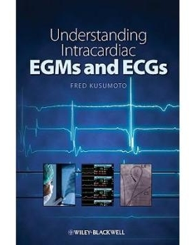 预订 Understanding Intracardiac Egms and Ecgs 心脏内心电图与EGMs: 9781405184106