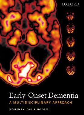 【预订】Early-Onset Dementia