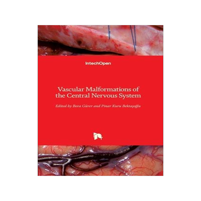 [预订]Vascular Malformations of the Central Nervous System 9781789857115