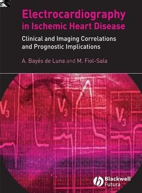 【预订】Electrocardiography in Ischemic Heart Disease - Clinical and Imaging Correlations and Prognostic Implicati...