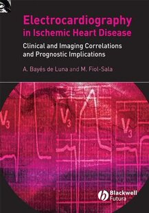 【预订】Electrocardiography in Ischemic Heart Disease - Clinical and Imaging Correlations and Prognostic Implicati...
