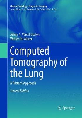 【预订】Computed Tomography of the Lung