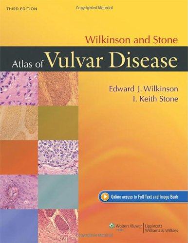 【预订】Wilkinson and Stone Atlas of Vulvar Disease