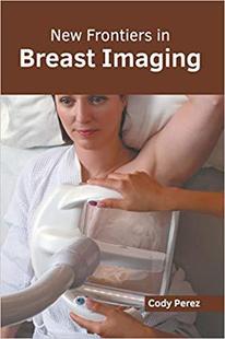 预售 Breast New Imaging Frontiers