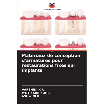 预订 Matériaux de conception d’armatures pour restaurations fixes sur implants: 9786136348384