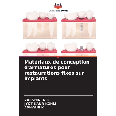 预订 Matériaux de conception d’armatures pour restaurations fixes sur implants: 9786136348384