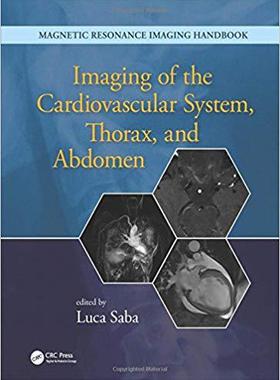 【预售】Imaging of the Cardiovascular System, Thorax, and Abdomen