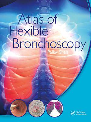 [预订]Atlas of Flexible Bronchoscopy 9781032477589