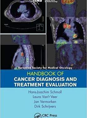【预售】Esmo Handbook of Cancer Diagnosis and Treatment Evaluation