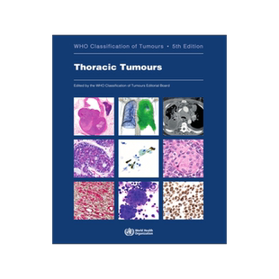 Thoracic Tumours: Who Classification of Tumours