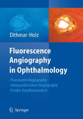【预订】Fluorescence Angiography in Ophthalmology