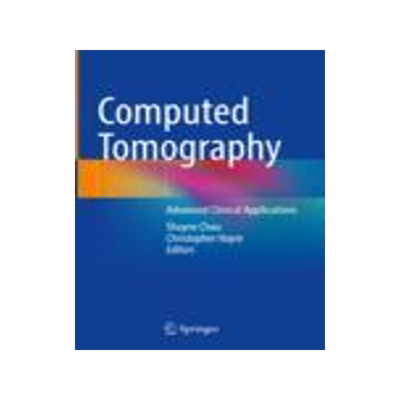 [预订]Computed Tomography