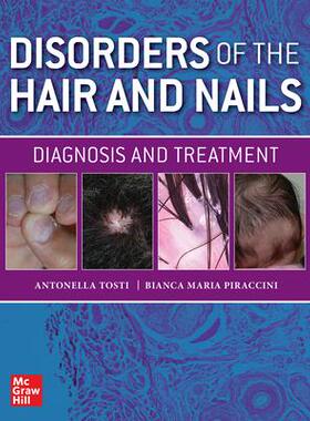 [预订]Disorders of the Hair and Nail: Diagnosis and Treatment 9781260462470