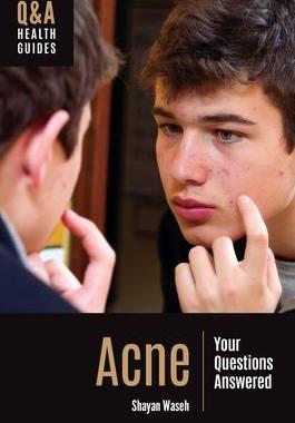 [预订]Acne: Your Questions Answered 9781440879685