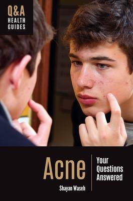 [预订]Acne: Your Questions Answered 9781440879685