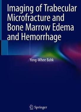 预订 Imaging of Trabecular Microfracture and Bone Marrow Edema and Hemorrhage