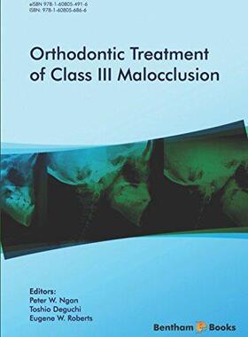 [预订]Orthodontic Treatment of Class III Malocclusion 9781608056866