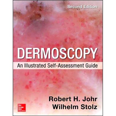 预订 Dermoscopy: An Illustrated Self-Assessment Guide, 2/E: 9780071834346