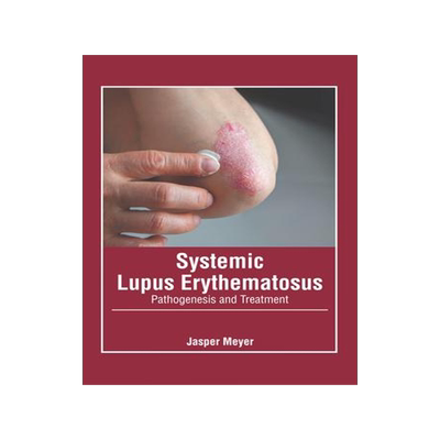 [预订]Systemic Lupus Erythematosus: Pathogenesis and Treatment 9781639272136