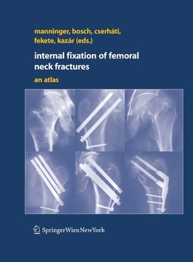 【预订】Internal fixation of femoral neck fractures