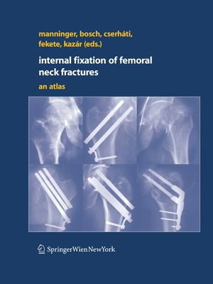 【预订】Internal fixation of femoral neck fractures