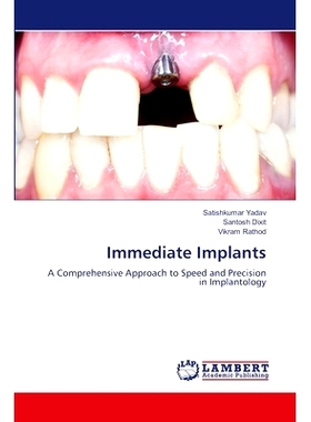 预订 Immediate Implants: 9786207995509