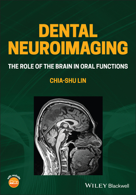 【预订】Dental Neuroimaging: The Role Of The Brain In Oral Functions 9781119724209