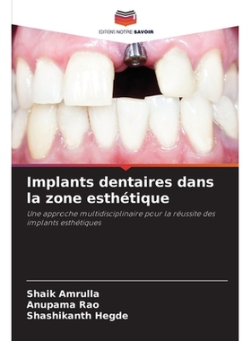 预订 Implants dentaires dans la zone esthétique: Une approche multidisciplinaire pour la réussite des implants esthét