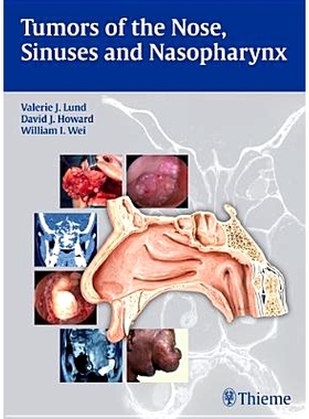 预订 Tumors of the Nose, Sinuses and Nasopharynx 鼻，鼻窦及鼻咽部肿瘤: 9783131471918