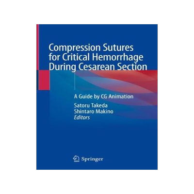 预订 Compression Sutures for Critical Hemorrhage During Cesarean Section