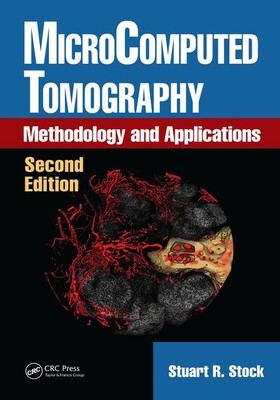 【预订】MicroComputed Tomography