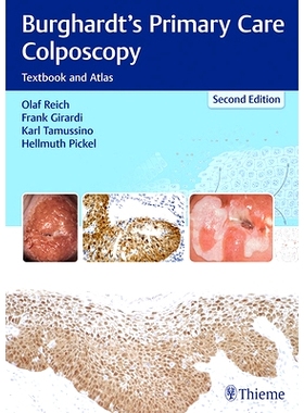 预订 Burghardt’s Primary Care Colposcopy: Textbook and Atlas 薄瑞光的初级保健的*镜检查: 9783131307224