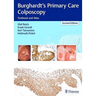 预订 Burghardt’s Primary Care Colposcopy: Textbook and Atlas 薄瑞光的初级保健的*镜检查: 9783131307224