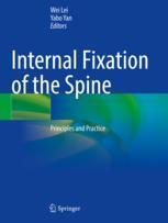 【预订】Internal Fixation of the Spine 9789811615641
