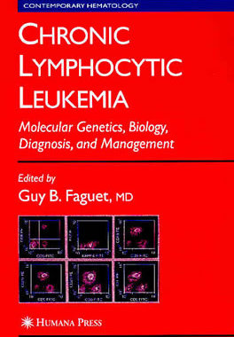 【预订】Chronic Lymphocytic Leukemia