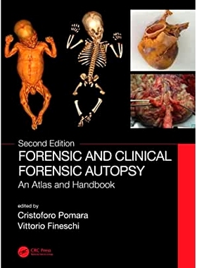 预订 Forensic and Clinical Forensic Au*sy: An Atlas and Handbook 法医与临床法医尸检：图集与手册 第2版: 9780367502782