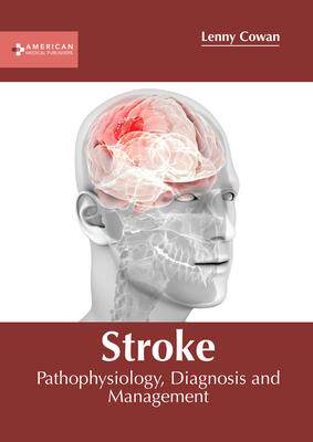 [预订]Stroke: Pathophysiology, Diagnosis and Management 9781639273317