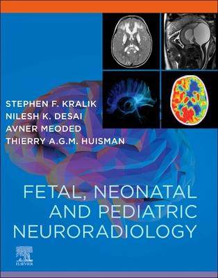 [预订]Fetal, Neonatal and Pediatric Neuroradiology 9780323796958