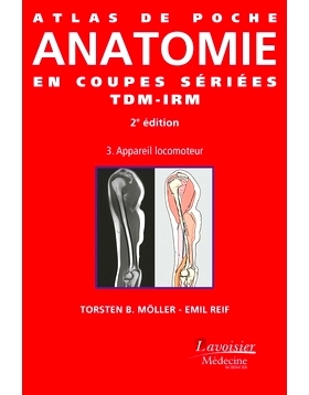 预订 Atlas de poche d’anatomie en coupes sériées TDM-IRM. Vol. 3. Appareil locomoteur 袖珍 CT-MRI 切片解剖图谱。航班