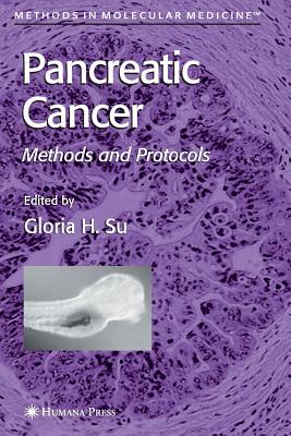 【预订】Pancreatic Cancer