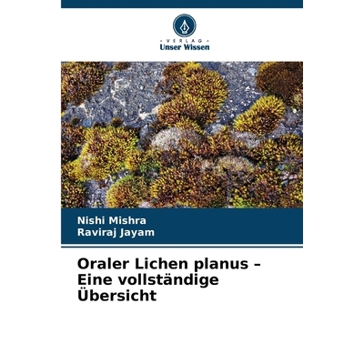 预订 Oraler Lichen planus - Eine vollständige Übersicht: DE: 9786209066665